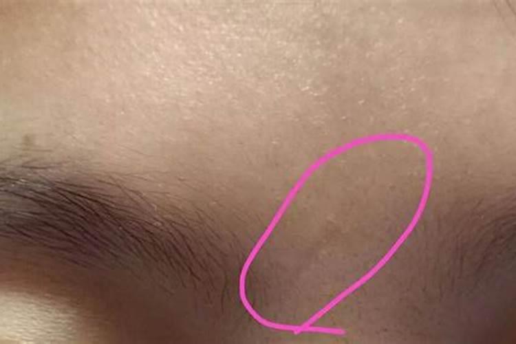 印堂有疤的男人面相命运详解