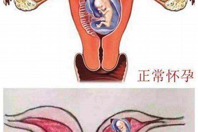 堕胎3次要给婴灵立几个牌位啊？
