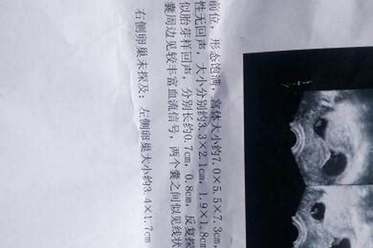 怀不上孩子是什么因果,佛经里无子女是什么因果