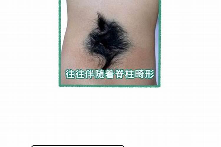 命格富贵胸口长一根白毛