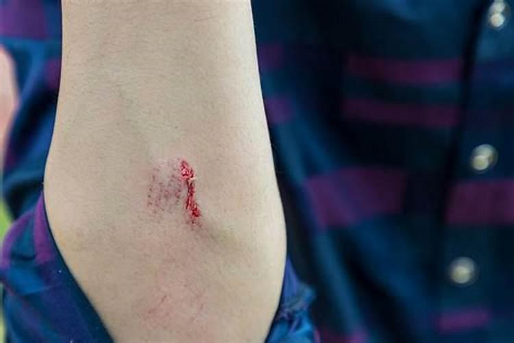 女人梦到自己手被割破流血