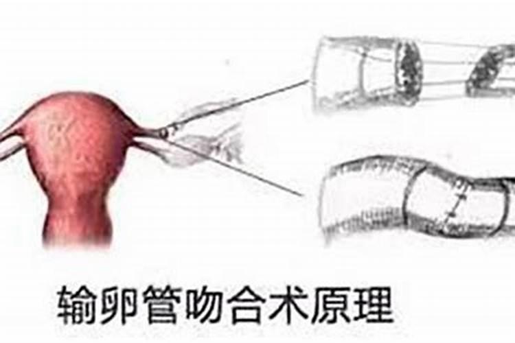 堕胎的危害,堕胎后如何还阴债？