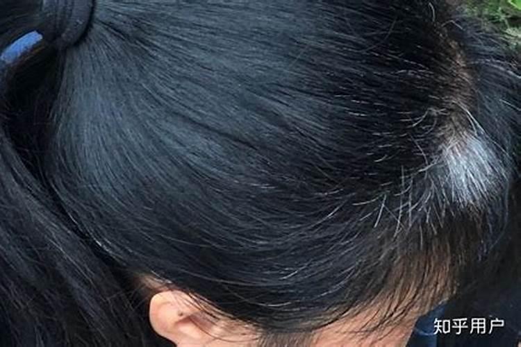 梦见自己长了几根白头发的预兆