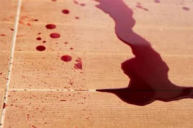 梦见腿受伤流血的意思 梦见腿受伤流血的寓意