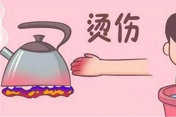 烧纸手被烫伤什么预兆