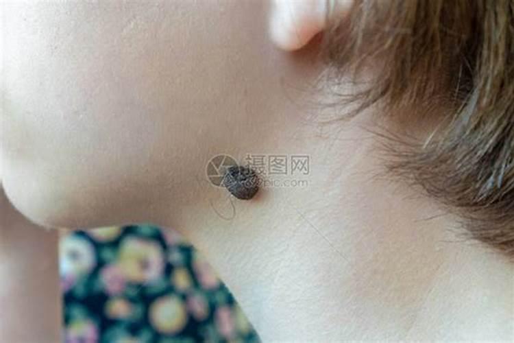 童子煞身上三个标志
