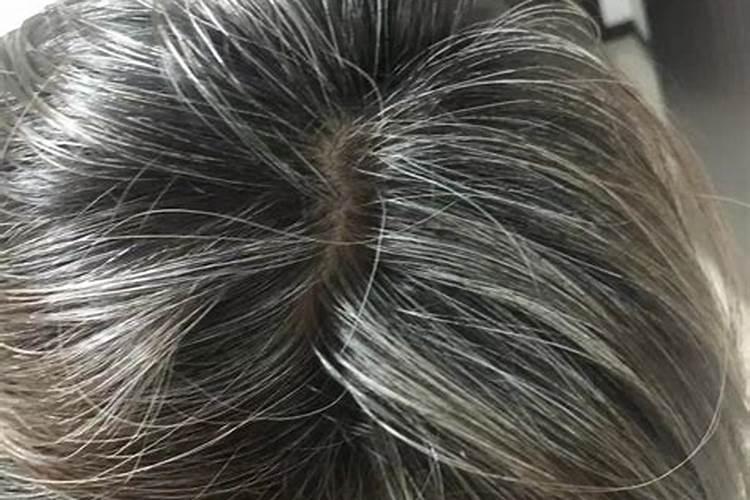 梦见女儿长白头发了的预兆