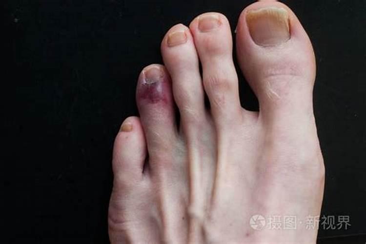 梦见女友背后一大伤口骨头外露的预兆