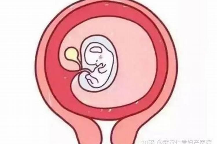 请问可以把流产后的胎囊拿去土埋了吗