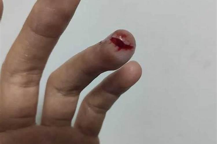 梦见亲人告诉自己将要去世