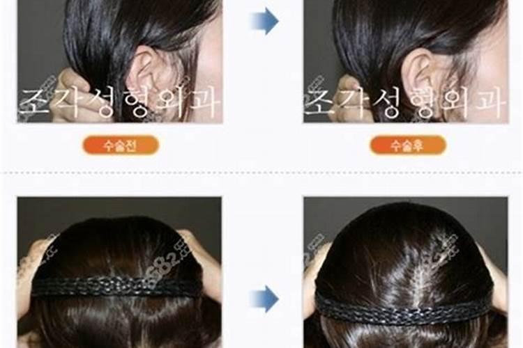 头顶中间凹陷的人命运如何