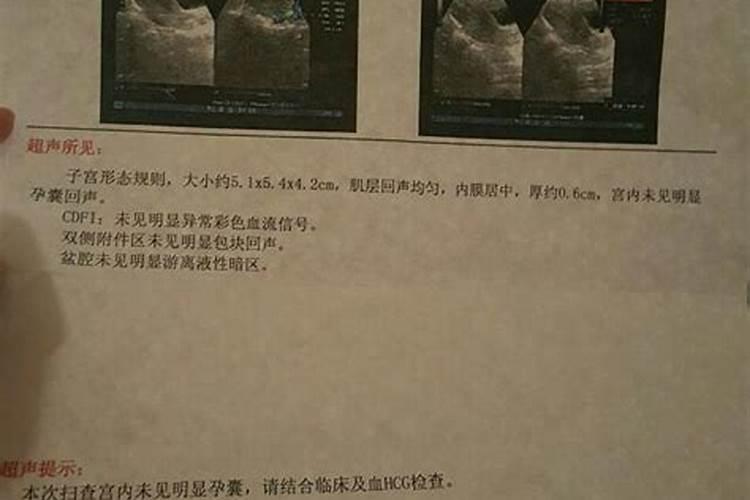 有没有哪个明星在古装剧中的凤冠霞帔让你印象深刻？