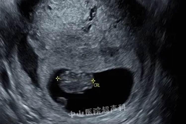 为什么牛年不能结婚