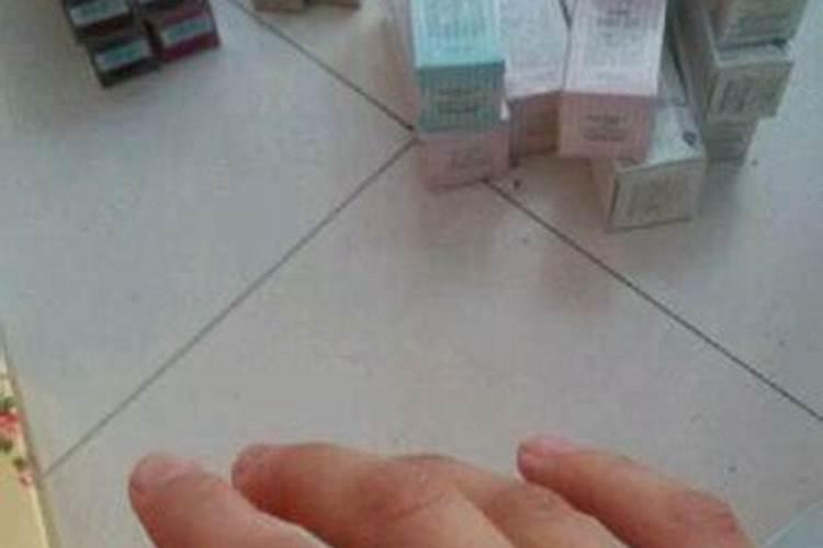 梦见自己划破手出血