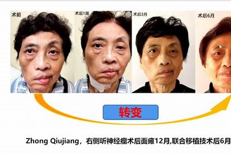 左眼跳是什么原因 眼睛左下跳有什么预兆？