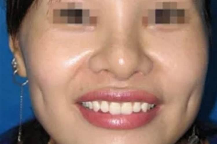 脸上有酒窝的面相如何