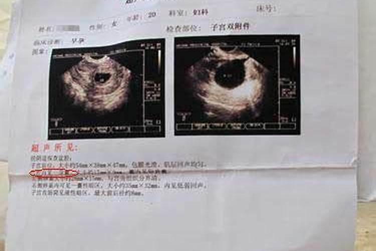 梦见自己老婆生病了的预兆