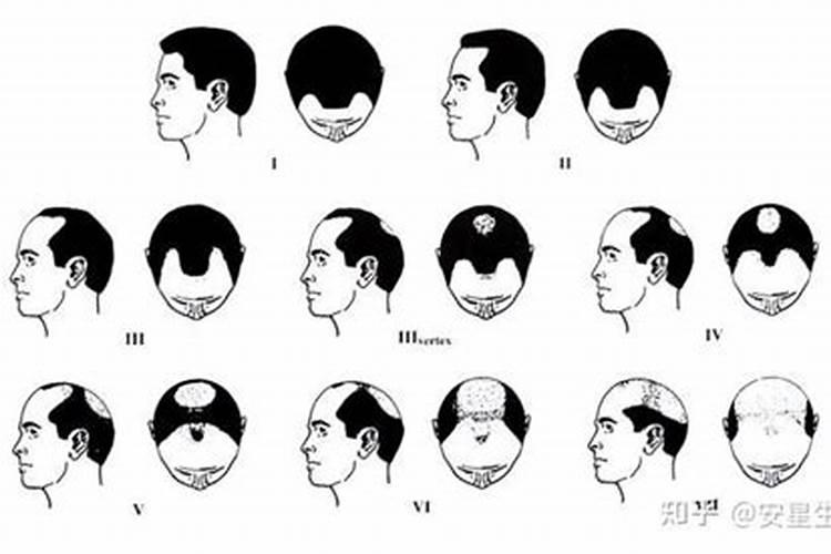 本命年有没有好穿的情侣内裤求推荐？