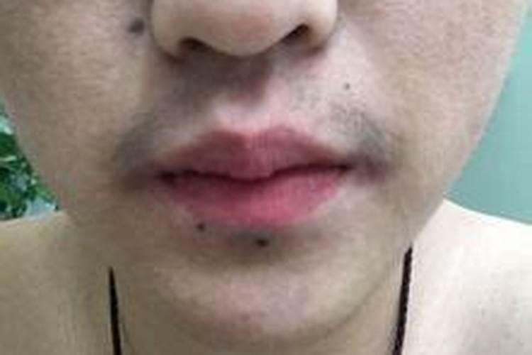 有福气的痣点掉了怎么办 眉毛上的痣不能点？