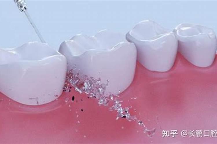 犯太岁在立春日怎么躲