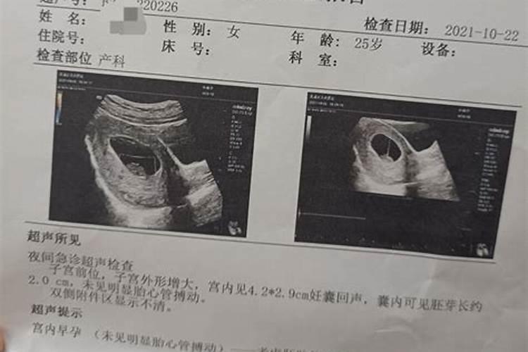 婴灵,不知道大家相信吗
