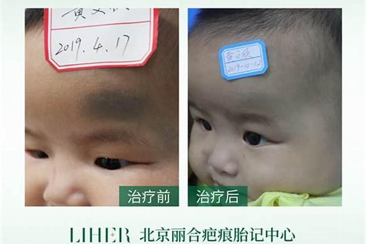孕妇梦见芋头