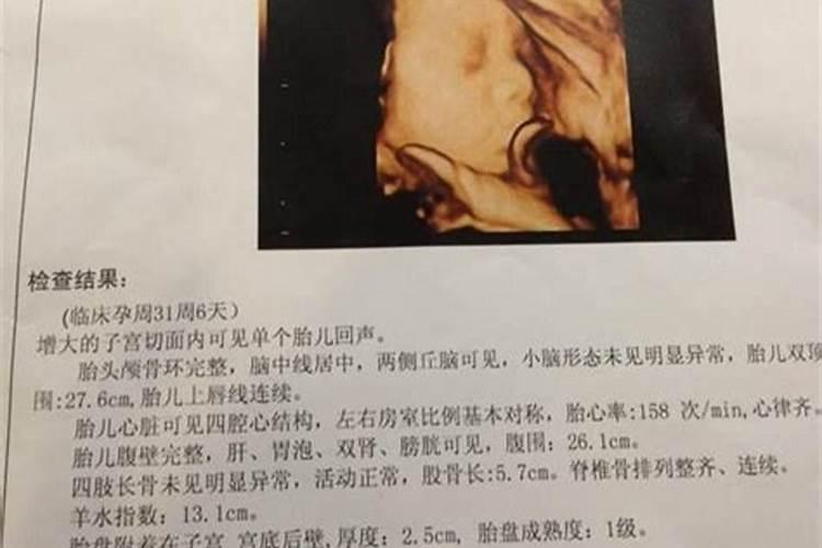 ...他帮我看了掌纹和面相之后,就知道我有堕胎的事,可是那胎才三、四...