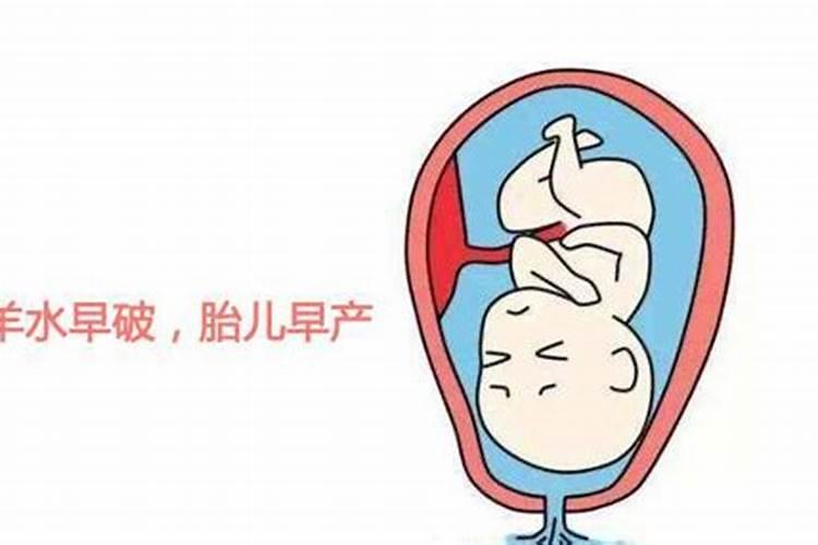 宝宝出生十几天就夭折了,是与我们无缘还是上天在捉弄我们啊？ 