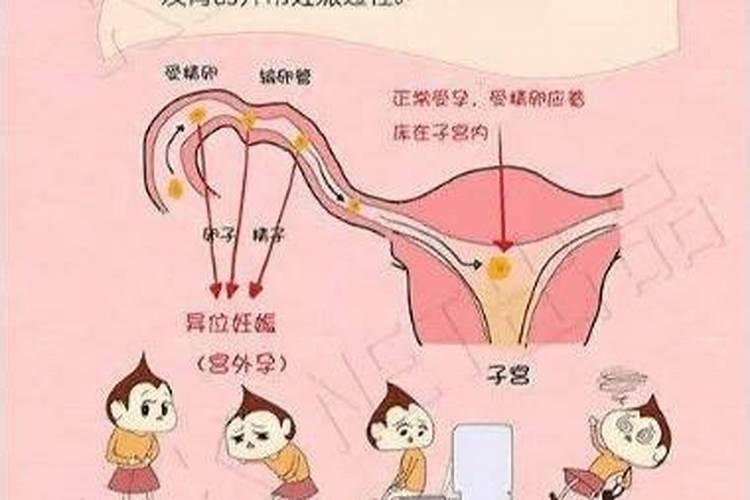 打掉孩子需要烧纸钱吗