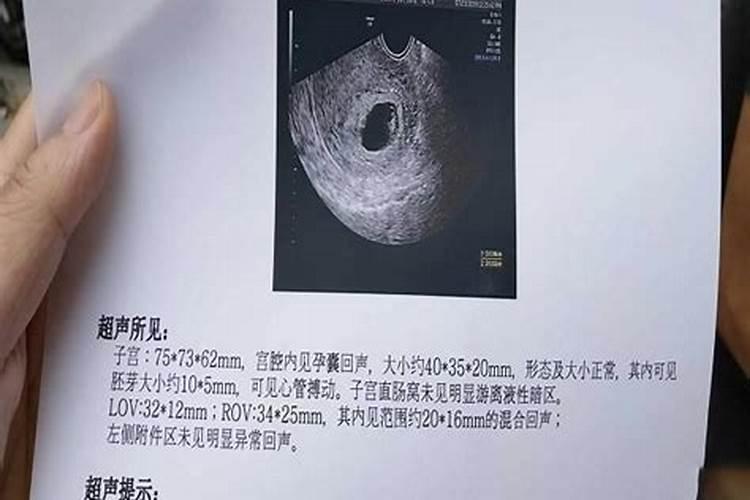 今年清明适合扫墓吗
