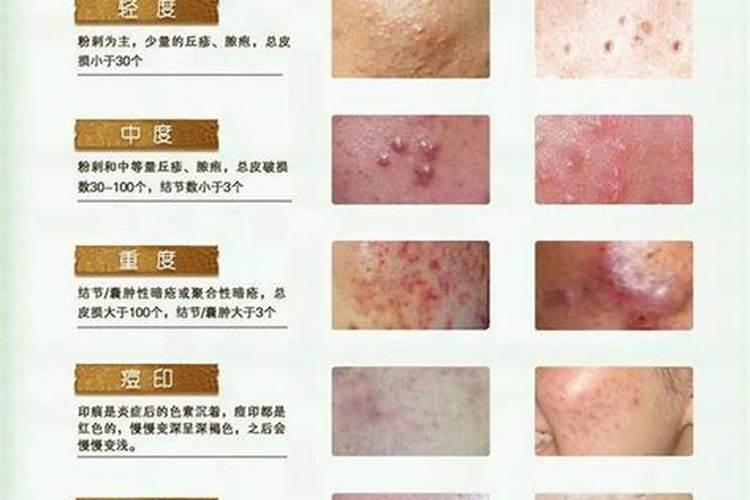 别人断我财路我要怎么报复？