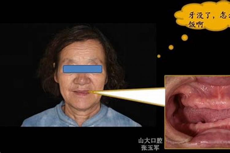 梦到已去世的奶奶牙齿掉了