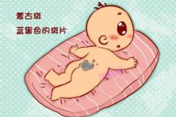 屁股上有胎记的寓意