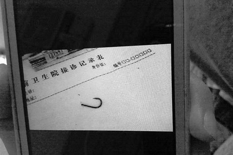梦见吃鱼吃出鱼钩钩在牙上啥意思