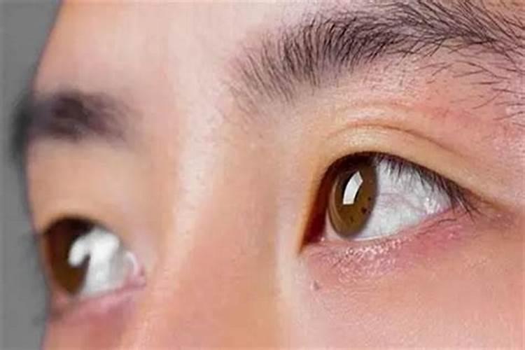右上眼皮跳测吉凶祸福 右上眼皮跳测吉凶预兆