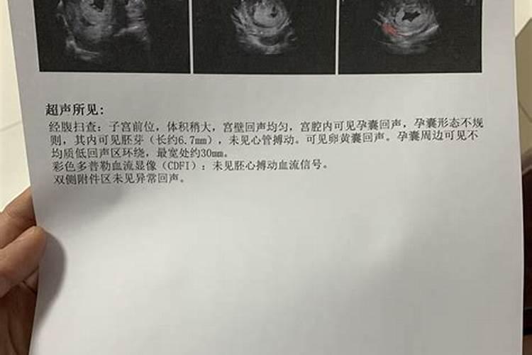 梦见很多人帮忙盖新房的预兆