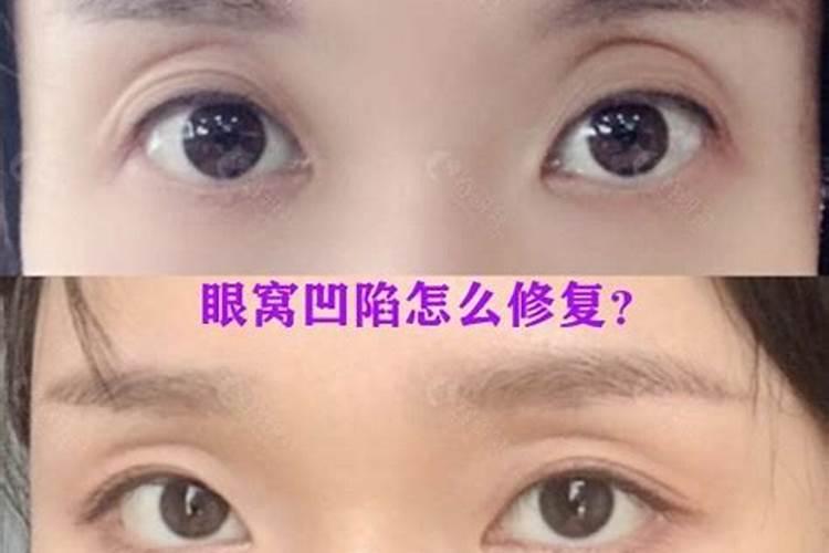 眼窝深陷的男人面相性格分析