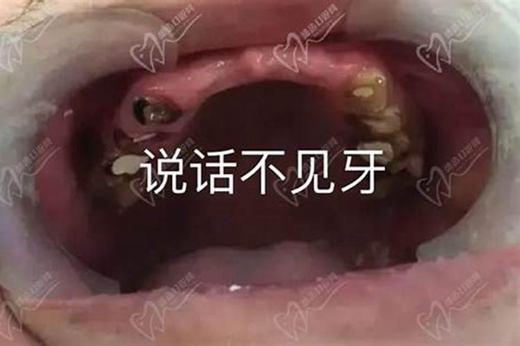 10年属蛇犯太岁怎么化解？急求有缘大师高人帮助!!!