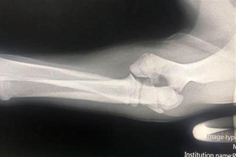 腊八排骨饭做法窍门