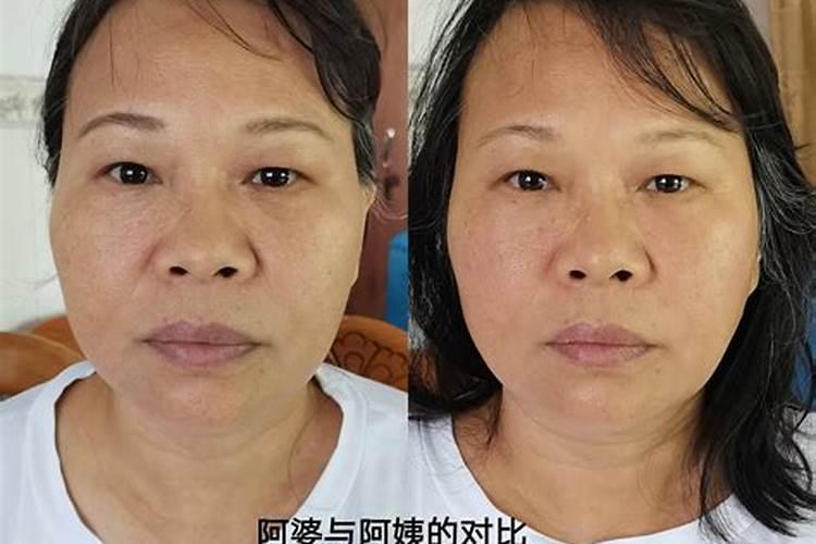 整容影响运气吗
