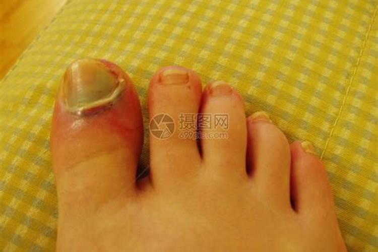 梦见骑毛驴是什么意思(骑什么组词)