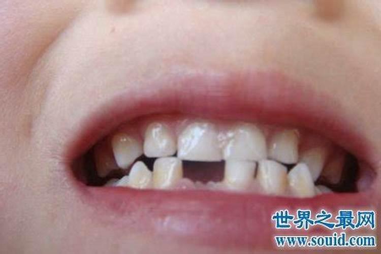做梦掉牙是吉兆还是凶兆