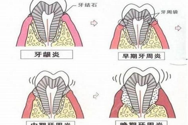 梦到自己牙齿松动是什么预兆