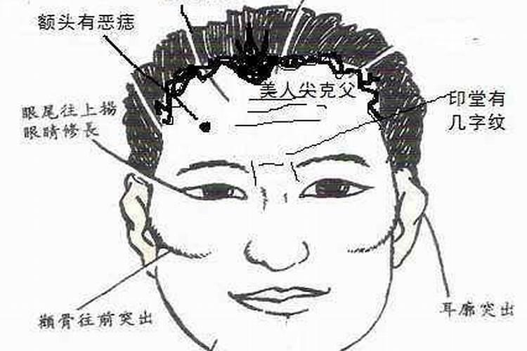 点痣会影响一个人的运气吗