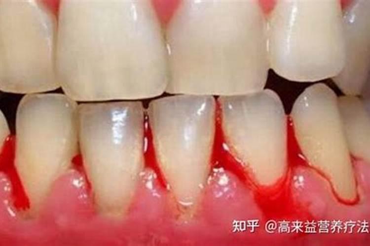 属猪2025年犯太岁怎么化解