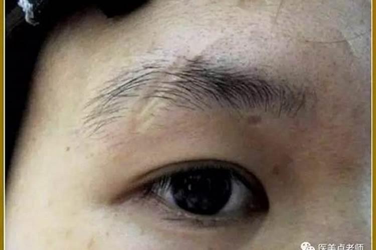 右眉毛有疤是命太好了
