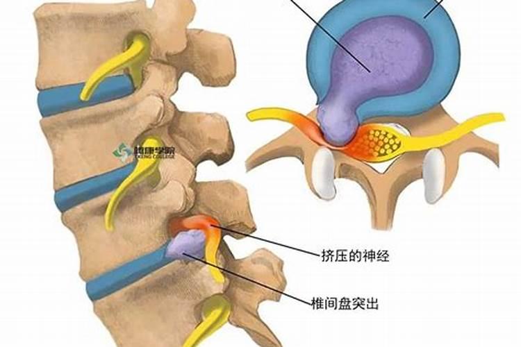 梦见自己窝屎是什么意思呀
