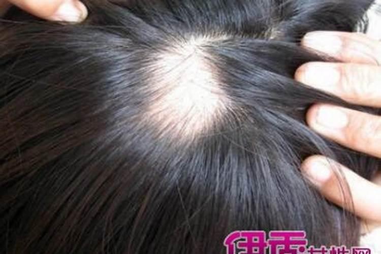 梦到本人头发一抓就断半截
