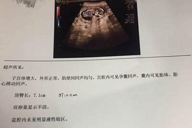 在佛学中,堕胎的人要怎样消除罪孽？