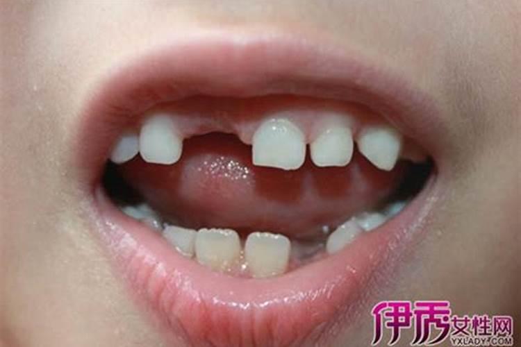 梦到牙齿掉了预示着什么